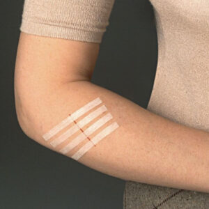 3M Steri-Strip Wundverschlussstreifen